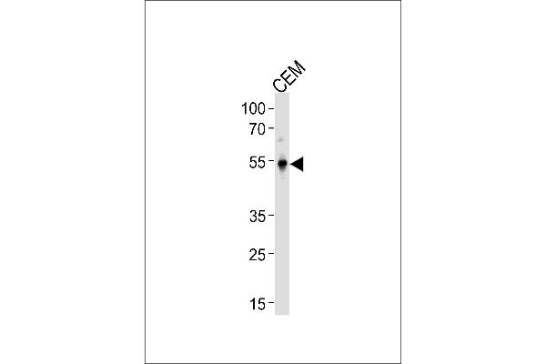 KLF5 anticorps  (C-Term)