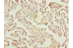 Immunohistochemistry of paraffin-embedded human lung tissue using ABIN7175170 at dilution of 1:100 (RAD23A anticorps  (AA 2-201))