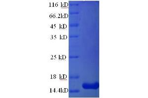 SDS-PAGE (SDS) image for Glucagon-Like Peptide 1 Receptor (GLP1R) (AA 24-145), (Extracellular) protein (His tag) (ABIN5713470)