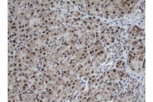 Image no. 3 for anti-Cullin 4B (CUL4B) (AA 1-300) antibody (ABIN1490724)