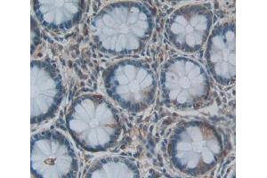 Used in DAB staining on fromalin fixed paraffin- embedded rectum tissue