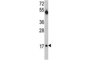 Western blot analysis of UBE2V1 antibody and mouse cerebellum tissue lysate.