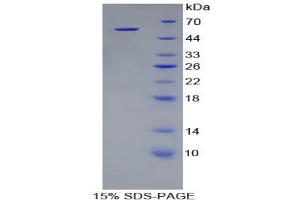 SDS-PAGE analysis of Rat Kallikrein 8 Protein. (Kallikrein 8 Protein (KLK8))