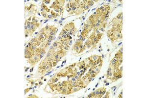 Immunohistochemistry of paraffin-embedded Human gastric using ARHGAP25 antibody at dilution of 1:100 (x400 lens). (ARHGAP25 anticorps)