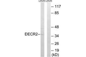 Western Blotting (WB) image for anti-2,4-Dienoyl CoA Reductase 2, Peroxisomal (DECR2) (AA 217-266) antibody (ABIN2890486) (DECR2 anticorps  (AA 217-266))