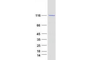 Validation with Western Blot