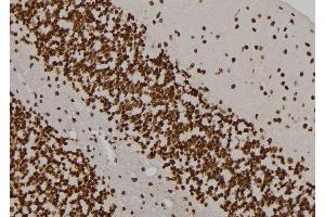 ABIN6263445 and ABIN6276995 at 1/100 staining Rat brain tissue by IHC-P. (MVP anticorps  (N-Term))