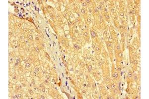 Immunohistochemistry of paraffin-embedded human liver tissue using ABIN7175490 at dilution of 1:100 (SEC22A anticorps  (AA 10-187))