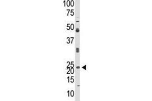 Image no. 1 for anti-Neurogenin 1 (NEUROG1) (N-Term) antibody (ABIN357407) (Neurogenin 1 anticorps  (N-Term))