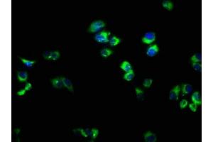 Immunofluorescence staining of PC-3 cells with ABIN7167298 at 1:166, counter-stained with DAPI. (RAB33A anticorps  (AA 1-237))