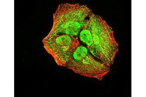Immunofluorescence analysis of Hela cells using ACVR1 mouse mAb (green).