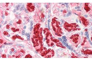 Detection of HBa1 in Human Erythrocytes of Placenta Tissue using Polyclonal Antibody to Hemoglobin Alpha 1 (HBa1) (HBA1 anticorps  (AA 1-142))