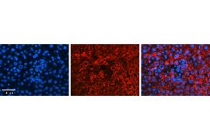 Rabbit Anti-GLYAT Antibody   Formalin Fixed Paraffin Embedded Tissue: Human Liver Tissue Observed Staining: Cytoplasm in hepatocytes Primary Antibody Concentration: 1:100 Other Working Concentrations: N/A Secondary Antibody: Donkey anti-Rabbit-Cy3 Secondary Antibody Concentration: 1:200 Magnification: 20X Exposure Time: 0.