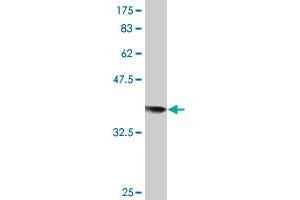 Western Blot detection against Immunogen (36. (RAD18 anticorps  (AA 332-430))