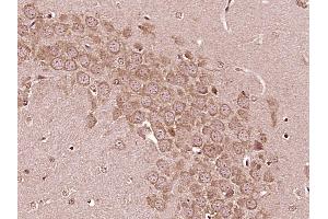 Paraformaldehyde-fixed, paraffin embedded Mouse brain Antigen retrieval by boiling in sodium citrate buffer (pH6. (IL6RA anticorps  (AA 351-460))