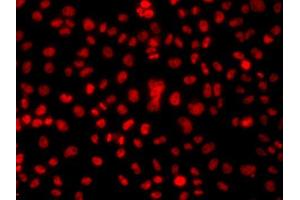Immunofluorescence analysis of A549 cells using HNRNPA1 antibody (ABIN5975570). (HNRNPA1 anticorps)