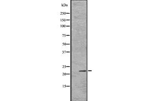 Western blot analysis Id1 using Jurkat whole cell lysates