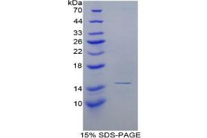 SDS-PAGE of Protein Standard from the Kit (Highly purified E. (Complement Factor B Kit ELISA)