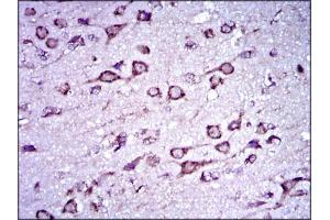 Immunohistochemical analysis of paraffin-embedded brain tissue tissues using DCX mouse mAb with DAB staining.