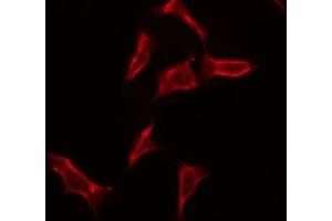 ABIN6275706 staining Hela by IF/ICC. (ZP4 anticorps  (Internal Region))