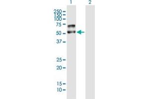 Western Blot analysis of PLD4 expression in transfected 293T cell line by PLD4 MaxPab polyclonal antibody. (Phospholipase D4 anticorps  (AA 1-489))