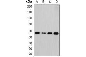 Western blot analysis of NEK3 expression in HepG2 (A), Hela (B), mouse kidney (C), rat brain (D) whole cell lysates.