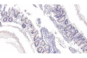 Detection of FXR in Rat Colon Tissue using Polyclonal Antibody to Farnesoid X Receptor (FXR) (NR1H4 anticorps  (AA 375-568))