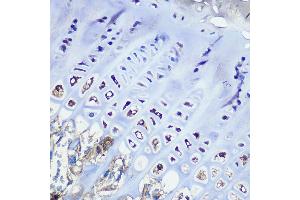 Immunohistochemistry of paraffin-embedded mouse bone marrow using Aggrecan Rabbit mAb (ABIN7265514) at dilution of 1:100 (40x lens). (Aggrecan anticorps)