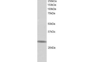 Western Blotting (WB) image for anti-Zinc Finger Protein 230 (ZNF230) (C-Term) antibody (ABIN2466468) (ZNF230 anticorps  (C-Term))