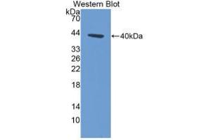 Western blot analysis of recombinant Human KRT14. (KRT14 anticorps  (AA 111-418))