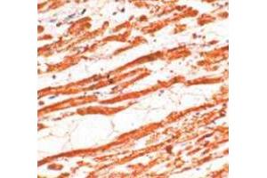 Immunohistochemical staining of human cardiac muscle stained with TNNT2 polyclonal antibody  at 1 : 50 for 10 min at RT. (Cardiac Troponin T2 anticorps)
