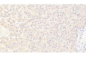 Detection of COX4I1 in Human Liver Tissue using Polyclonal Antibody to Cytochrome C Oxidase Subunit IV Isoform 1 (COX4I1)