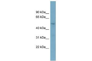 TOM1L2 antibody used at 1 ug/ml to detect target protein. (TOM1L2 anticorps)