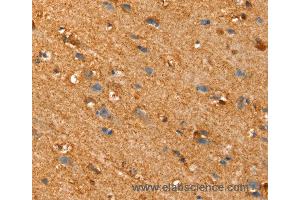 Immunohistochemistry of Human brain using SLC25A4 Polyclonal Antibody at dilution of 1:30 (SLC25A4 anticorps)