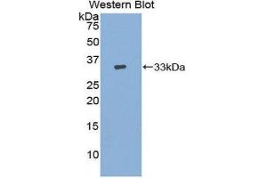 Western Blotting (WB) image for anti-Adenylate Cyclase 9 (ADCY9) (AA 1029-1282) antibody (ABIN3206678) (ADCY9 anticorps  (AA 1029-1282))
