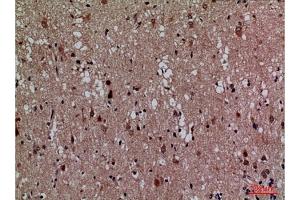Immunohistochemical analysis of paraffin-embedded human brain, antibody was diluted at 1:100. (CDK4 anticorps  (N-Term))