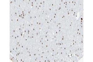 ABIN6266615 at 1/100 staining human brain tissue sections by IHC-P. (Cyclin L1 anticorps  (C-Term))