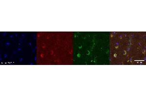Immunohistochemistry (IHC) image for anti-PDZ and LIM Domain 5 (PDLIM5) antibody (ABIN7456030)