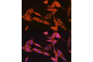 Immunofluorescence analysis of NIH-3T3 cells using PIK3C3/VPS34 Rabbit mAb (ABIN7269328) at dilution of 1:100 (40x lens). (PIK3C3 anticorps)