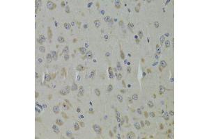 Immunohistochemistry of paraffin-embedded mouse brain using RPL9 Antibody.