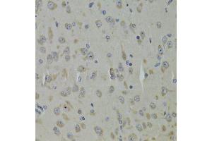 Immunohistochemistry of paraffin-embedded mouse brain using RPL9 Antibody. (RPL9 anticorps  (AA 1-192))