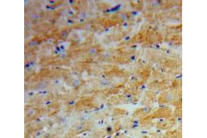 Used in DAB staining on fromalin fixed paraffin-embedded Heart tissue