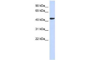 SGMS2 antibody used at 1 ug/ml to detect target protein. (Sphingomyelin Synthase 2 anticorps  (N-Term))