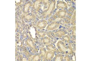 Immunohistochemistry of paraffin-embedded rat kidney using MBP antibody. (MBP anticorps)