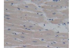 Detection of FMOD in Rat Heart Tissue using Polyclonal Antibody to Fibromodulin (FMOD)