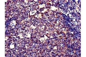 Immunohistochemistry of paraffin-embedded human tonsil tissue using ABIN7150247 at dilution of 1:100 (POLH anticorps  (AA 408-609))