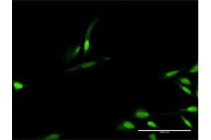 Immunofluorescence of purified MaxPab antibody to TIMELESS on HeLa cell. (TIMELESS anticorps  (AA 1-1208))