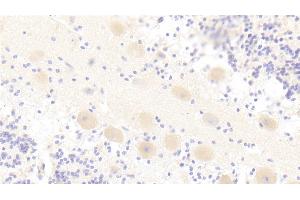 Detection of TIRAP in Porcine Cerebellum Tissue using Polyclonal Antibody to Toll Interleukin 1 Receptor Domain Containing Adaptor Protein (TIRAP)