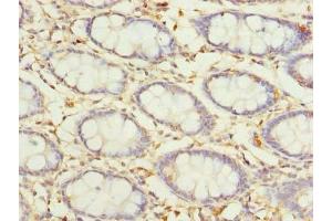 Immunohistochemistry of paraffin-embedded human colon tissue using ABIN7164641 at dilution of 1:100 (GLT25D2 anticorps  (AA 351-626))