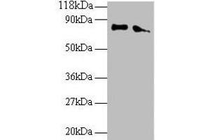 Western blot All lanes: ERP29 antibody at 2 μg/mL Lane 1: EC109 whole cell lysate Lane 2: 293T whole cell lysate Secondary Goat polyclonal to rabbit IgG at 1/15000 dilution Predicted band size: 29, 6 kDa Observed band size: 80 kDa (ERP29 anticorps  (AA 40-251))